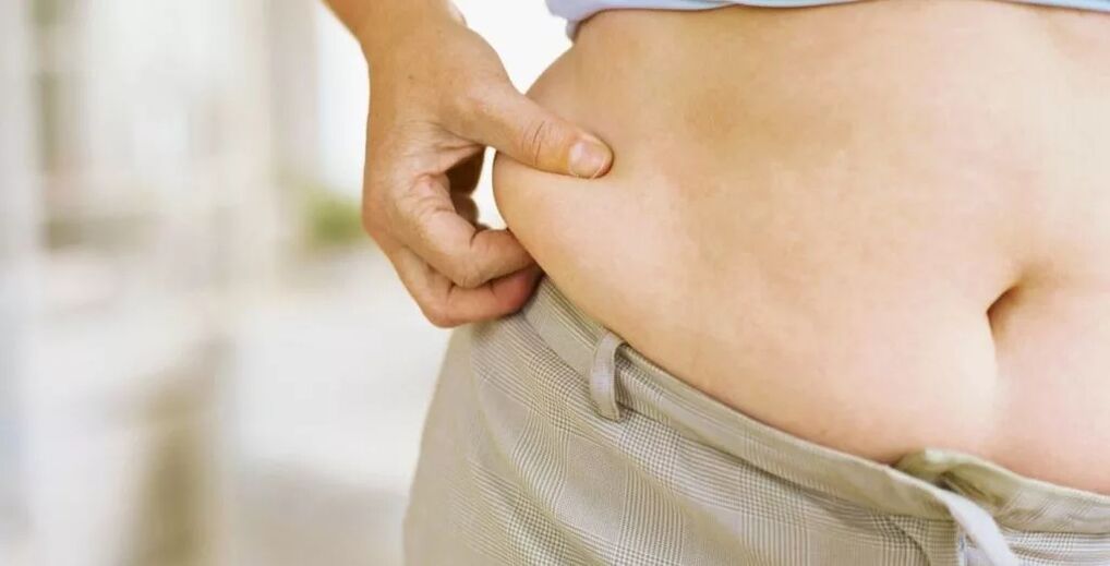 Obesidad y venas varicosas